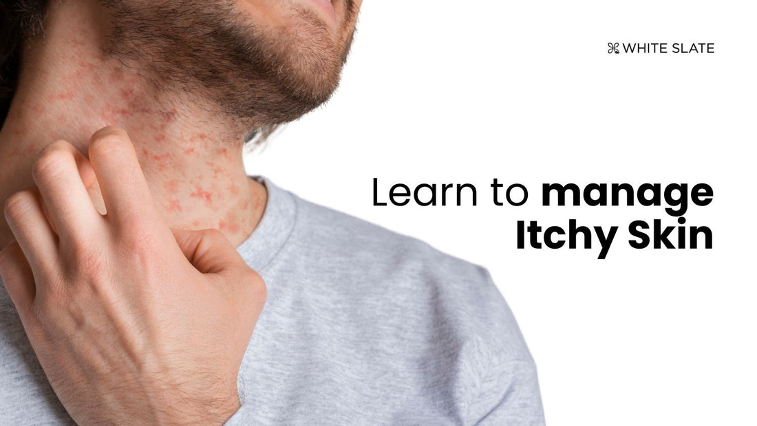Learn to manage itchy skin