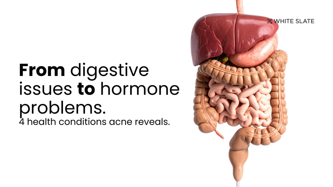 Health Conditions Acne Reveals