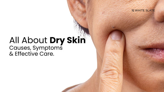 All About Dry Skin