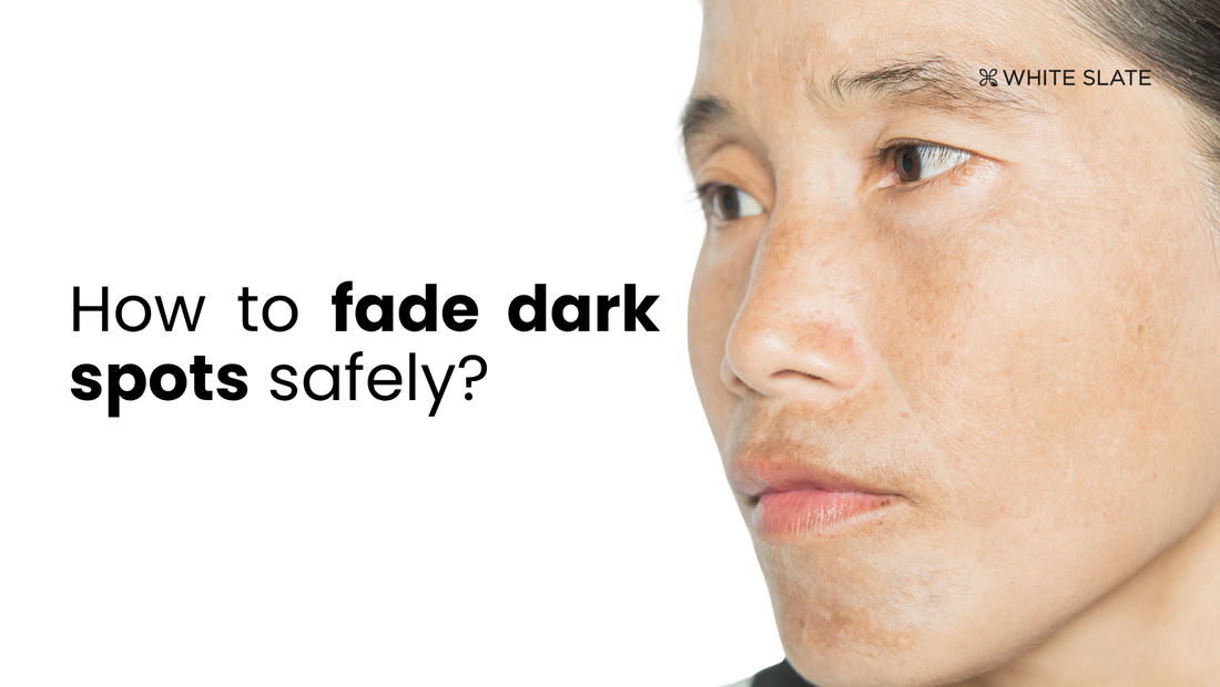 Dark Spots