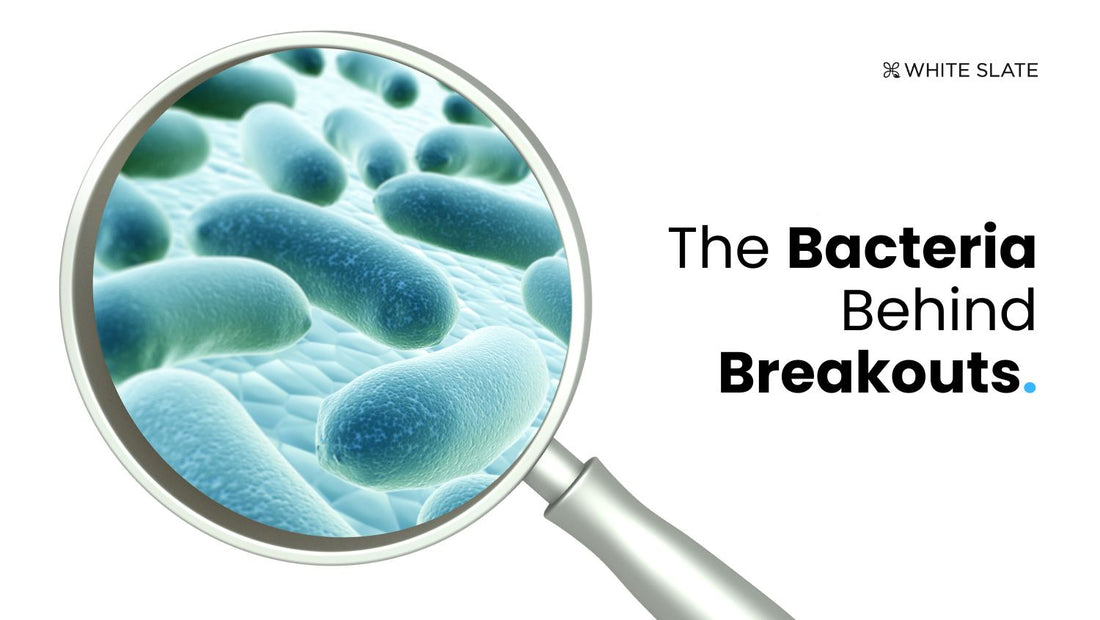 Bacteria Behind Breakouts