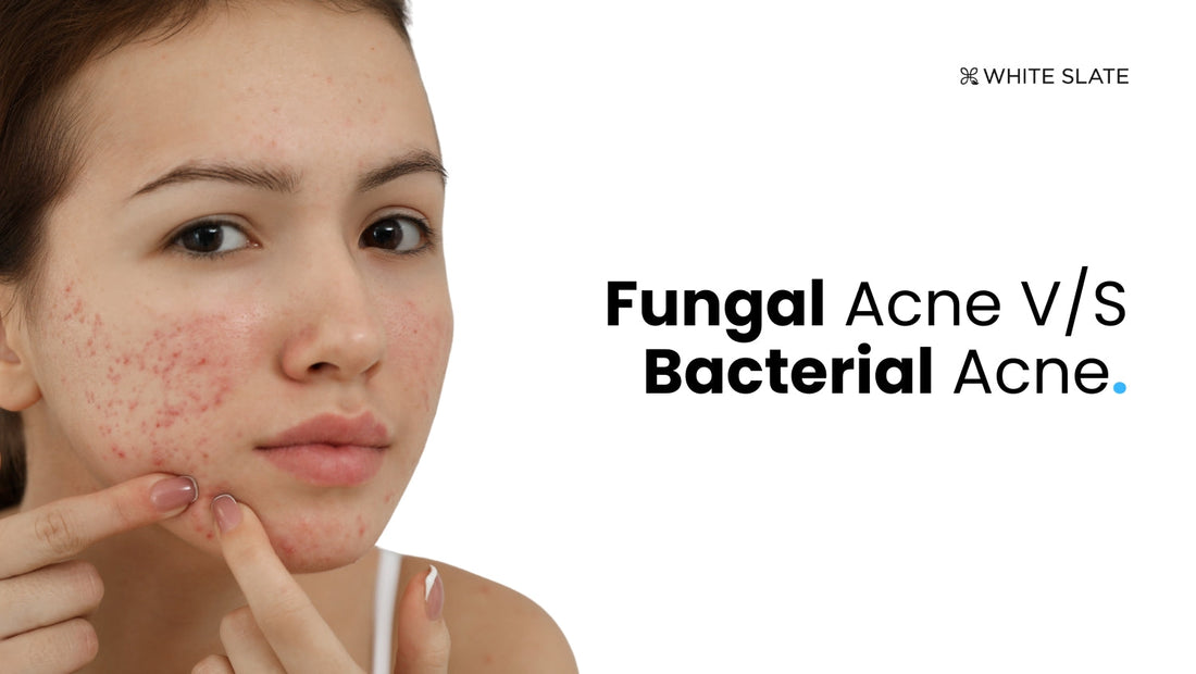 Fungal acne vs Bacterial acne