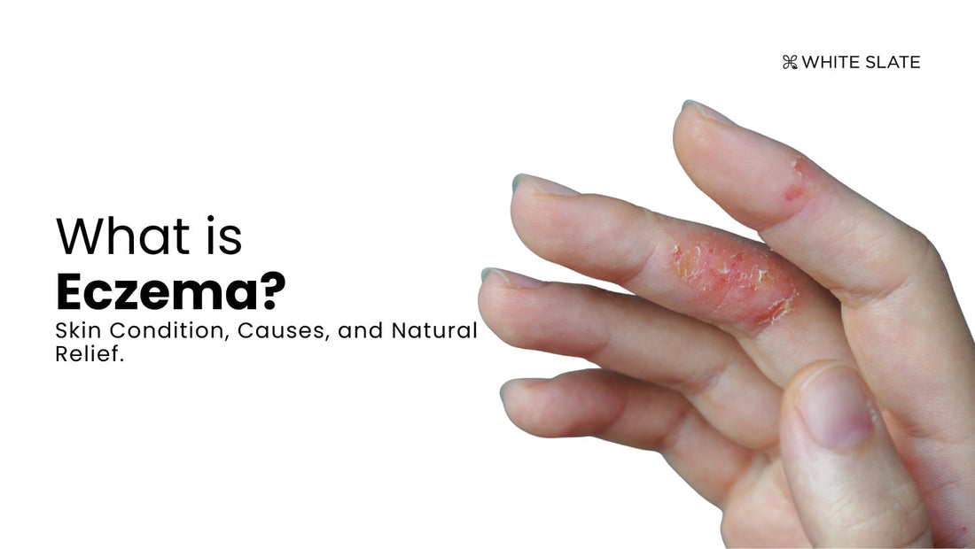 What Causes Eczema: Surprising Triggers You Need to Know