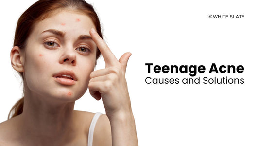 Teenage Acne Solutions