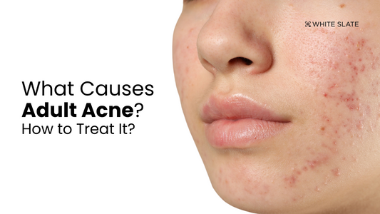 Adult Acne