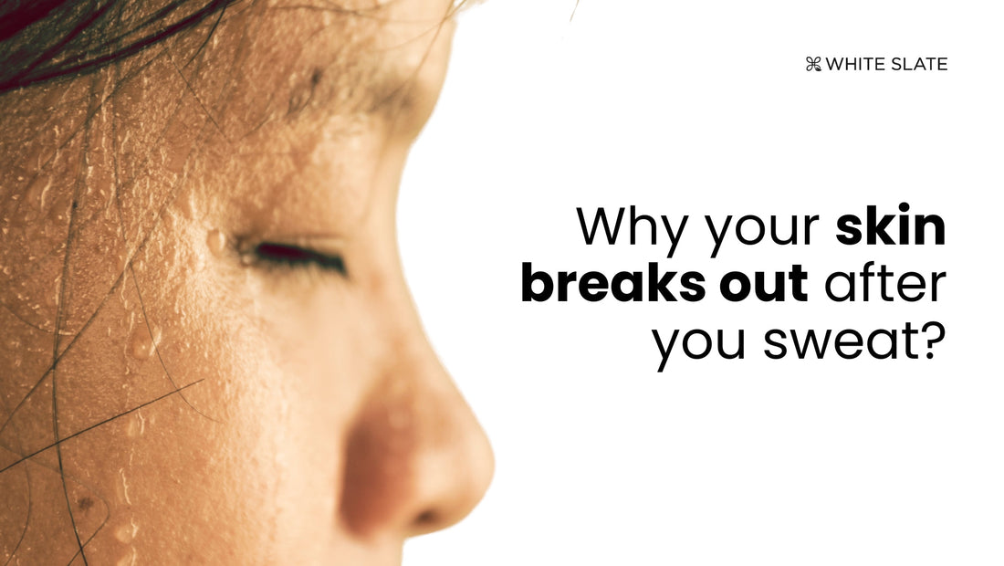 Skin Breaks Out