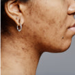Face Spots
